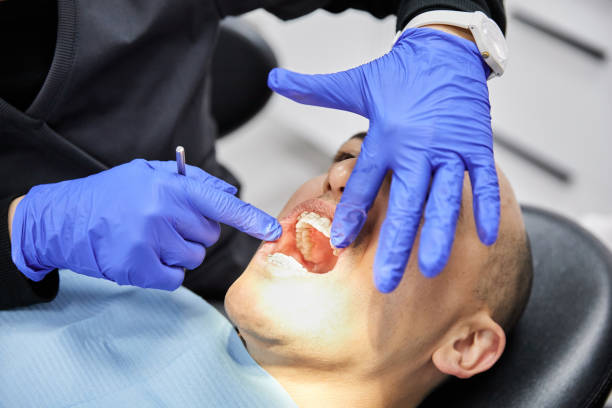 Best Emergency Dental Care for Broken or Chipped Teeth in Xenia, OH